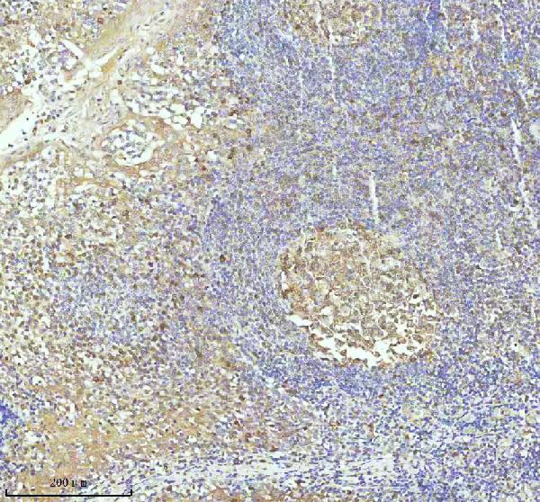 IHC - Anti-Caspase 3 Rabbit Monoclonal Antibody ABO16560